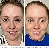 Bioelements Equalizer Hydrating Facial Toner 6 fl oz — image 5