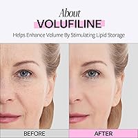 RECIPE Volufiline 100% Ampoule 0.33 fl oz — image 4