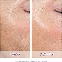 iS CLINICAL Active Peel System — image 5