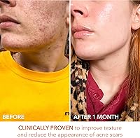 Dr. Dennis Gross Alpha Beta Universal Daily Peel (60 Treatments) — image 9