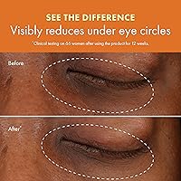 Origins GinZing Brightening Eye Cream 0.5 Fl Oz — image 7