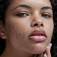 Obagi CLENZIderm M.D. Pore Therapy Exfoliating BHA Toner 5oz — image 9