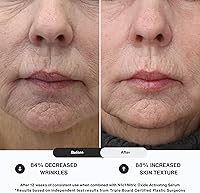 N1O1 Moisturizer Face Cream 1.75oz — image 7