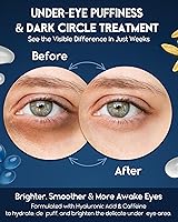 Pharmlitalia Under Eye Cream for Puffiness and Bags — image 3