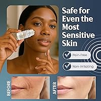 Microrevive Titanium Micro Infusion Facial System — image 8