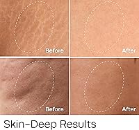 Hot Vita Vitamin C Body Oil — image 5