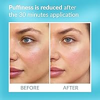 Talika Eye Therapy Patch - Reusable Under Eye Treatment (6 Refills) — image 3