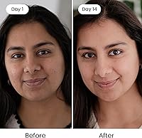 Shankara Kumkumadi Oil 18mL — image 3