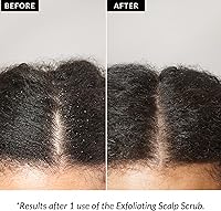 Love Ur Curls Exfoliating Scalp Scrub 150mL — image 4