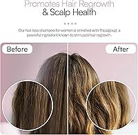 Foltene Strengthening Shampoo for Women – 6.76 fl. oz. — image 4