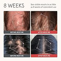 iRestore Anti Hair Loss and Thinning Shampoo - 8oz — image 2