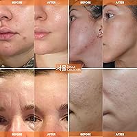 SeoulCeuticals Snail Mucin Moisturizer 4oz — image 3