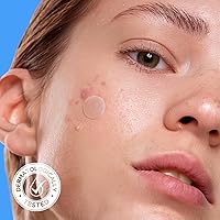 Avarelle Pimple Patches for Face, 200 Count — image 4