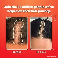 HAIRtamin Vegan Gummy Stars Hair Vitamins 3-Pack — image 6