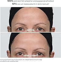 M-61 PowerGlow Peel Extra Strength 20% Glycolic Acid Facial Peel — image 8