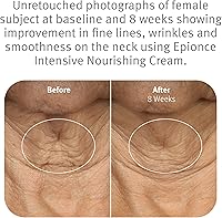 Epionce Intensive Nourishing Cream 1.76oz — image 4