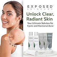 Exposed Skin Care Acne Treatment Kit — image 9