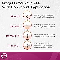 C'rcle Minoxidil for Women 5% Foam 4-Month Supply — image 6