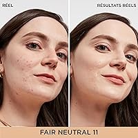 IT Cosmetics Bye Bye Dark Spots Concealer + Brightening Serum – Medium Coverage — image 2