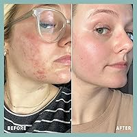 Bohemia Skin BOHO Skin Cleansing Balm 2oz — image 7