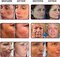 ABERA Saffron Serum for Melasma Treatment, 1.01 Fl Oz — image 6