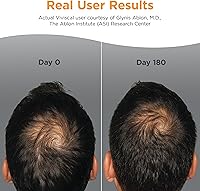 Viviscal Men's Hair Growth Supplements 180 Tablets — image 3