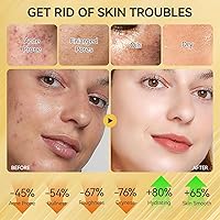 Onkessy Skin Care Set — image 4