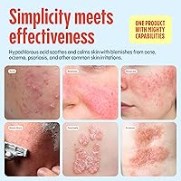 Mighty Mist Premium Hypochlorous Acid Spray for Acne & Eczema, 4oz — image 8