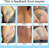 EarayWax Waxing Kit for Women & Men — image 5