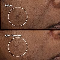 Clinique Even Better Clinical Brightening Moisturizer 200mL — image 4