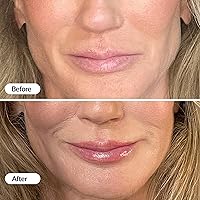 Vibriance Hydrating Lip Volumizer 0.14 fl oz — image 4