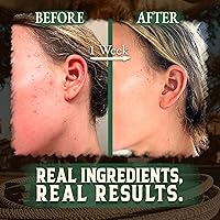 Wrath & Remedy Organic Beef Tallow for Skin - 4oz Eucalyptus — image 5