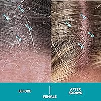 DS Labs Dandrene Dandruff Conditioner 205mL — image 4