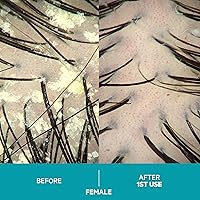 DS Labs Dandrene Dandruff Shampoo 205mL — image 5