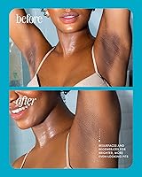 Truly Beauty Jelly Booster Pigment Treatment Body Potion Scar Treatment 3.1oz — image 5