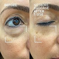 Dr. Brandt Needles No More No More Baggage Eye De-Puffing Gel, 0.23oz — image 12