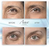 Aqua Mineral Puffy Eye Gel – 1 oz — image 3