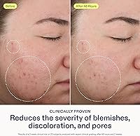 Skinfix 2% BHA Cleanser 5oz — image 3