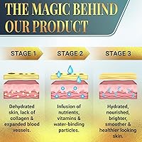 Matykos Forehead and Under Eye Wrinkle Patches — image 6