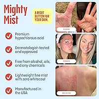 Mighty Mist Premium Hypochlorous Acid Spray for Acne & Eczema, 4oz — image 2