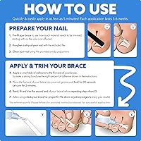 CurveCorrect Ingrown Toenail Treatment Kit — image 8