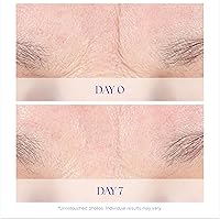 iS CLINICAL Youth Intensive Crème 50mL — image 4