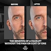 Beverly Hills Mens Instant Facelift and Eye Serum Treatment — image 5