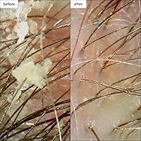 Briogeo Scalp Revival Soothe + Detoxify Minis Kit — image 3