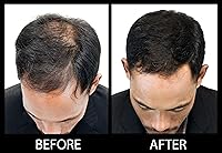 MAXX Pro-Series Volumizing Hair Fibers – 25g (Black) — image 7