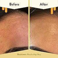 ECZEMA HONEY Nourishing Face Serum 1 Oz — image 4