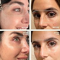 Dermaclara Silicone Facial Patches - Anti-Wrinkle Patches for Frown, Smile Lines & Forehead — image 3