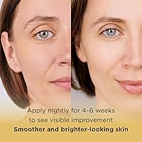 MATKAS Korean Active Capsule 0.05% Retinal Hybrid Cream 1.7oz — image 6