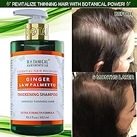 Botanical Hair Growth Shampoo Ginger Saw Palmetto 10.2oz — image 3