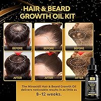 Beaueli Minoxidil for Men Beard Growth Kit 5% — image 2
